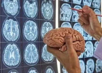 Día Mundial del Cerebro: la importancia de su cuidado preventivo
