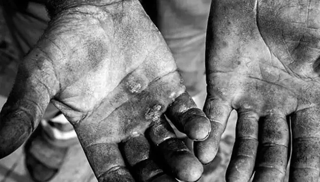 Executivo capacidadá criar medidas de acolhimento para vítimas de trabalho análogo a escravidão