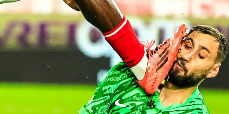 Así quedó el rostro de Donnarumma tras pisotón | Video