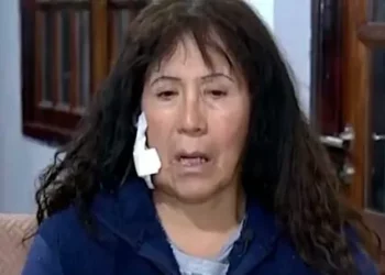 “Pensé que me estaba muriendo”: el dramático suceso de la turista atacada con un ladrillazo camino a Ezeiza