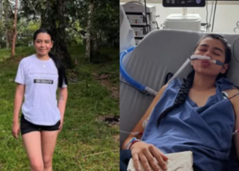Tatiana, la señorita que recibió trasplante bipulmonar que salvó su vida: ‘Han sido días en donde me duele el alma’