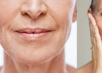 ‘Arrugas de marioneta’: así puede disimular y atenuar las líneas al lado de la jeta de manera eficaz