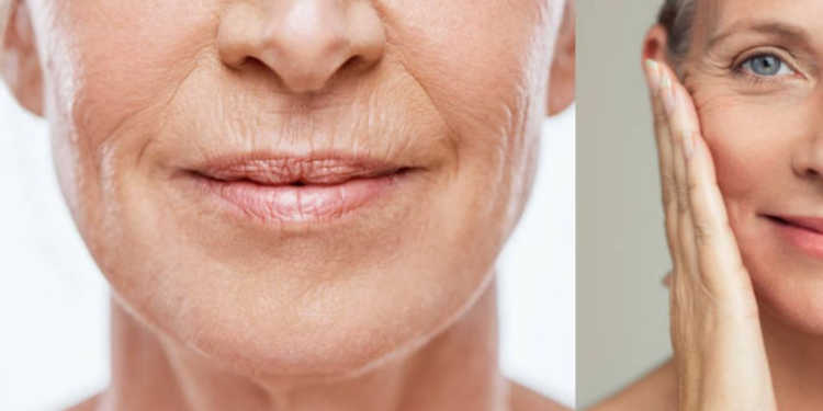 ‘Arrugas de marioneta’: así puede disimular y atenuar las líneas al lado de la jeta de manera eficaz