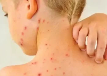 Alerta sanitaria por sarampión en Argentina: investigan a 98 contactos de la familia rusa que viajó por ocho provincias con la indisposición